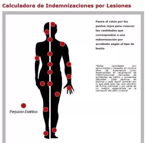 Calculadora indemnizaciones accidentes