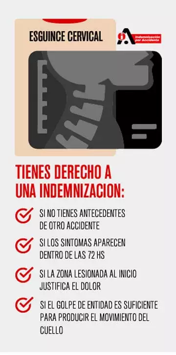 derecho a indemnizacion por esguince cervical segun baremo